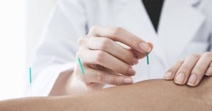dry needling pros and cons