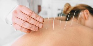 dry needling pros and cons